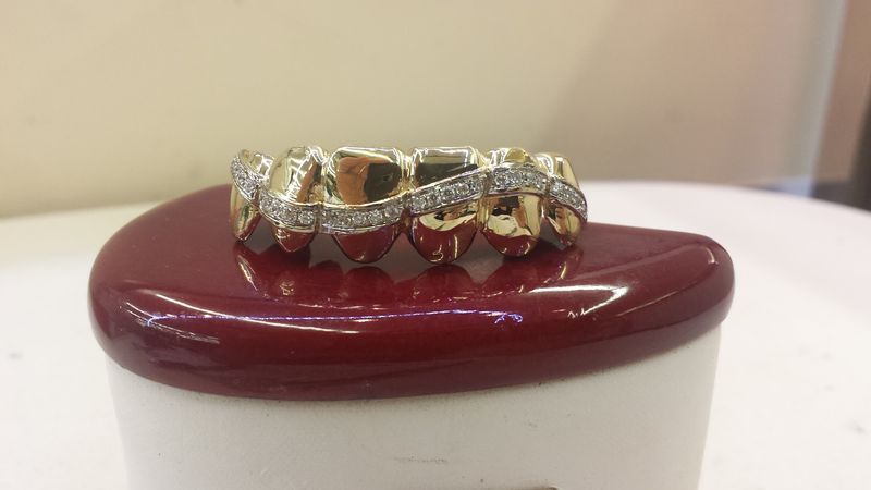 Gold Teeth and Custom Grillz Vendors Gold Teeth and Custom Grillz Vendors